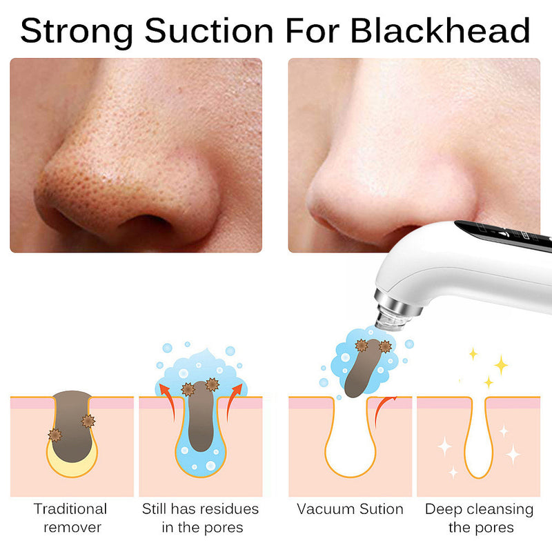 Blackhead Remover T Zone Powerful Vacuum Suction Pore Acne Pimple Removal