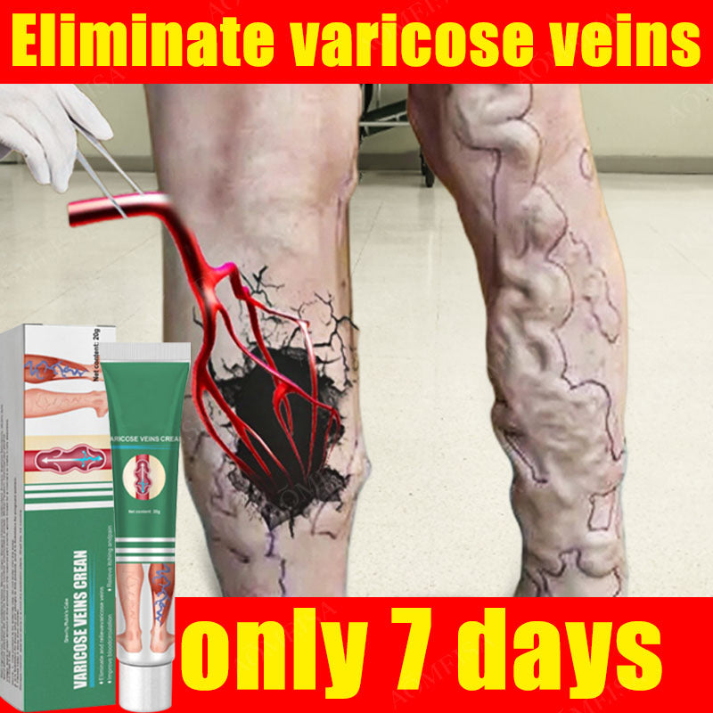 VascuRelief: Powerful Ointment for Varicose Veins and Spider Vein Pain Relief